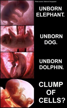 Unborn Infant